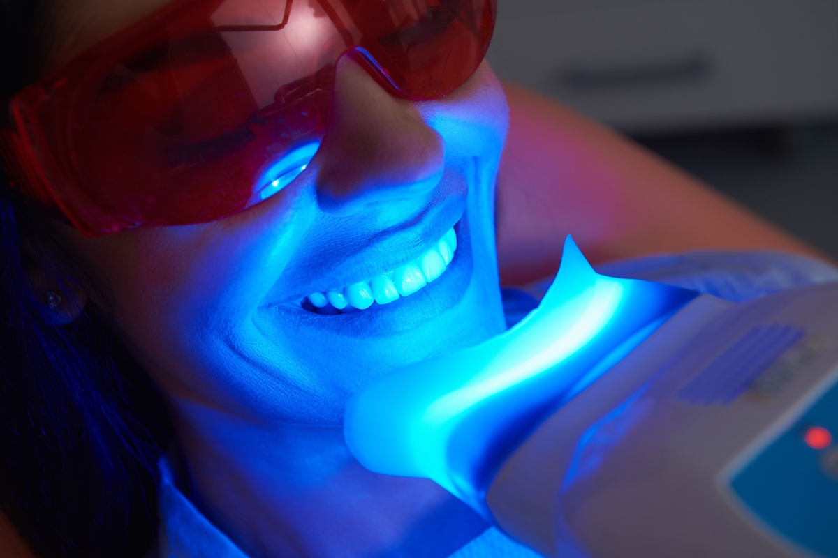 teeth whitening in Las Vegas