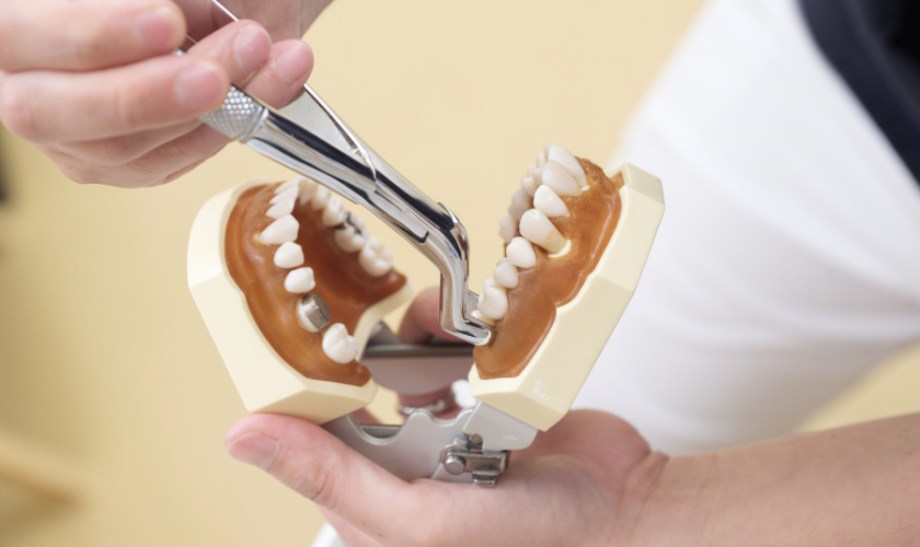 wisdom tooth extraction